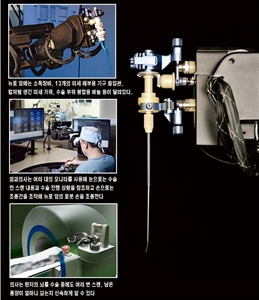뇌 수술하는 로봇