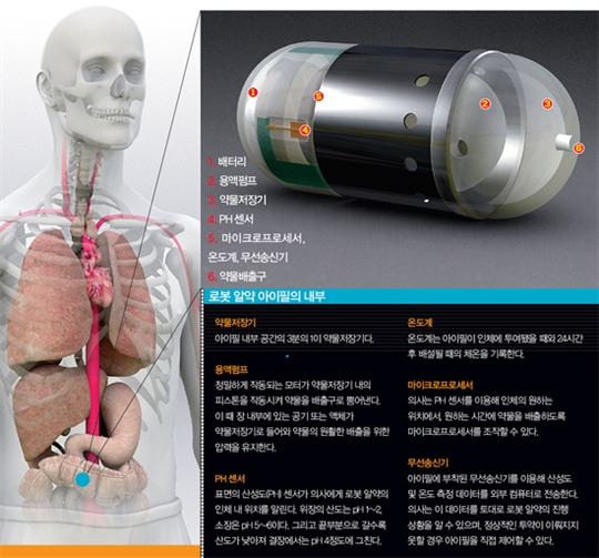 똑똑하게 장(腸) 치료하는 로봇 알약