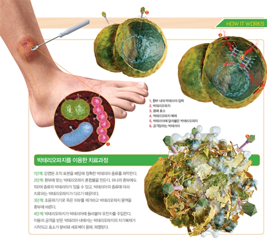 차세대 살균 바이러스 박테리오파지