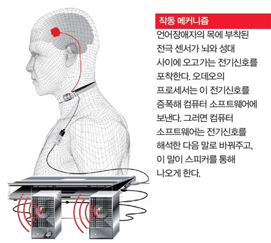 언어장애자의 입… 전자식 음성 박스