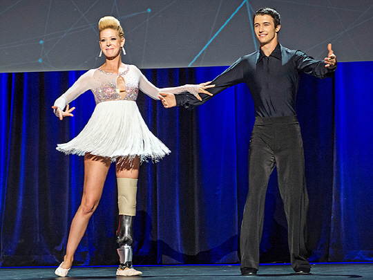 보스턴 테러로 왼쪽 다리를 잃은 댄서 에이드리언 헤이즐럿데이비스(왼쪽)가 휴 허 교수가 개발한 전자 의족을 차고 TED 강연장에서 남성 댄서와 함께 춤을 추고 있다./TED 동영상 캡처