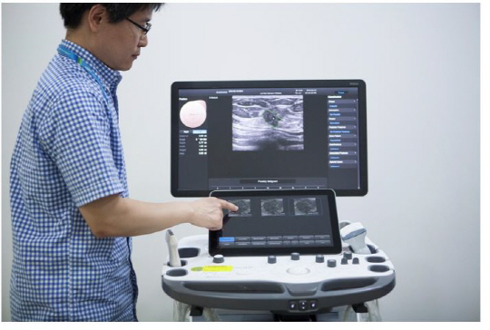 삼성메디슨 관계자가 세계 최초로 개발한 인공지능 유방암 진단 초음파기기인 ‘S디텍트’를 소개하고 있다. /사진제공=삼성전자
