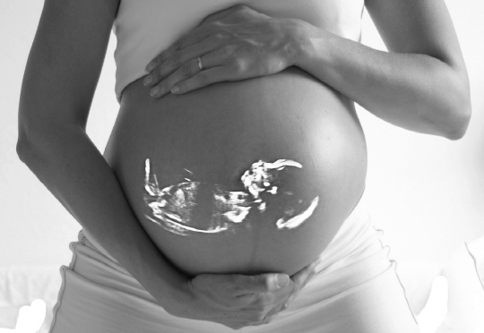 제일병원은 2014년 1월부터 올해 3월까지 ‘역아회전술’을 받은 임산부를 대상으로 한 조사결과를 밝혔다./출처=구글