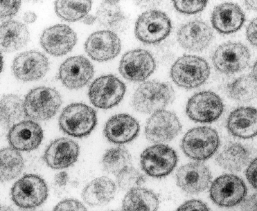 HIV-1 바이러스./출처=구글