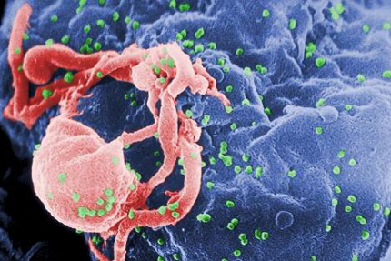 림프구(cultured lymphocyte)에서 뻗어 나오는 HIV-1 바이러스 입자들./출처=연합뉴스