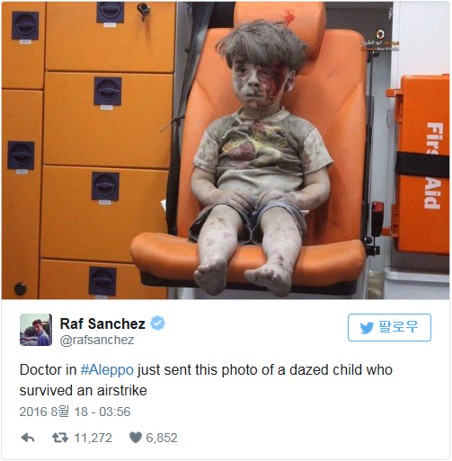 참혹한 시리아 공습 피해…'5살 아동' 사진 SNS서 '화제'