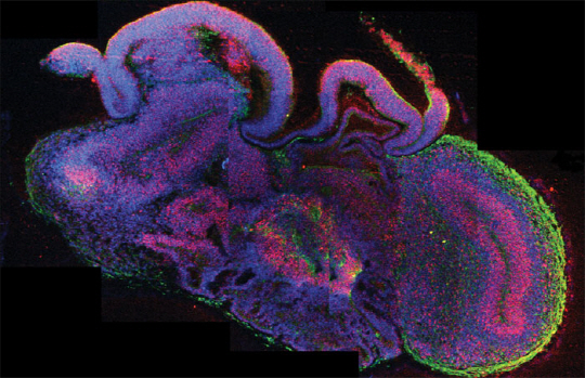 오스트리아 분자생명공학연구원이 실험실에서 배양한 ‘미니 뇌’의 단면. 지름 4mm정도로 작은 콩알 크기지만 해마·피질 등 인간의 뇌와 비슷한 구조를 갖췄다.