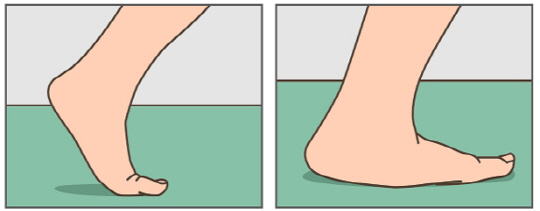 오른쪽 그림처럼 엄지발가락이 충분히 구부러지지 않으면 무릎에 무리가 간다.