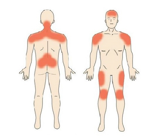 [썸&건강TIP]근육, 뭉치면 아프고 풀리면 상쾌하다.