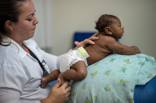 브라질의 한 병원에서 의료진이 소두증 확진을 받은 아기를 살펴보고 있다./AFP연합뉴스