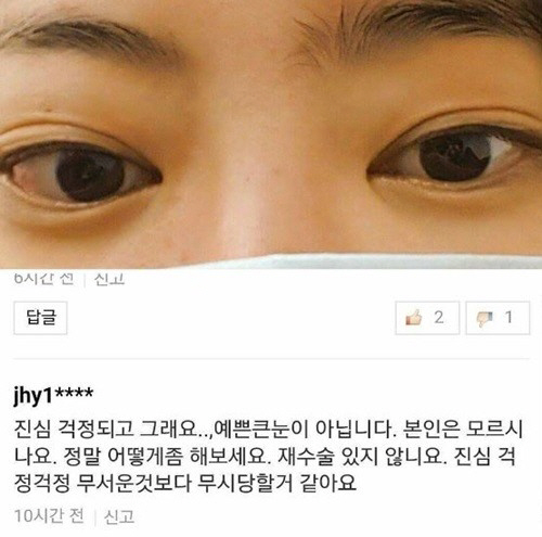 서유리, ‘그레이브스 병’앓고 있다…“앞트임, 뒤트임 아닌 안구 돌출”