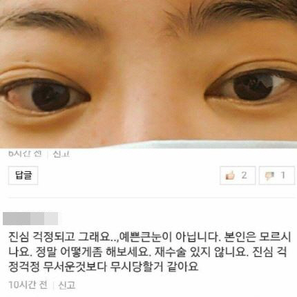 서유리, 성형의혹 해명 “그레이브스 병으로 안구돌출…응원 해주면 많은 힘 날 것 같다”