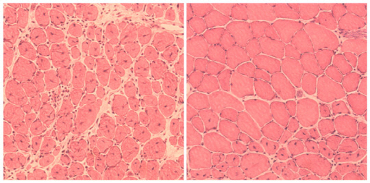 쥐의 약화된 근육 세포 수리 결과를 비교할 수 있는 사진. 재 프로그램  된 쥐 근육세포(오른쪽)가 원래 근육세포(왼쪽)에 비해 치밀해졌음을 확인할 수 있다. /사진=뉴욕타임스