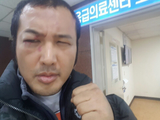 김보성, 로드FC 데뷔 경기서 부상…오른쪽 눈 시력 위해 수술 포기