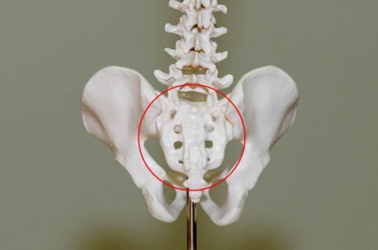 연세대 세브란스병원이 골수암 환자에게 이식하기 위해 3D프린터로 찍어낸 인공골반뼈(빨간색 동그라미 표시)의 모습. /사진제공=연세대 세브란스병원