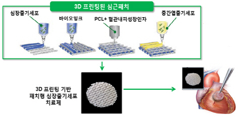 3D 세포 프린팅 기술을 적용한 심장세포 재생기술 개념도.