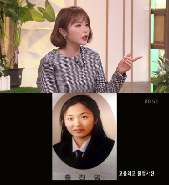 ‘아침마당’ 홍진영, 성형 전 사진 공개에 “전에도 괜찮았다…졸업사진은 좀 부었을 뿐” 웃음 선사