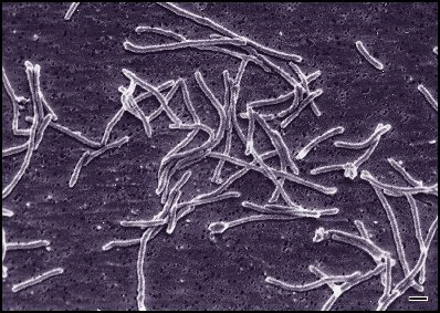 뜨거운 간헐천에 사는 세균  ‘써무스 아쿠아티쿠스’. 이 세균에서 찾은 ‘Taq DNA 중합효소’ 덕분에 PCR 기술이 완성됐다.