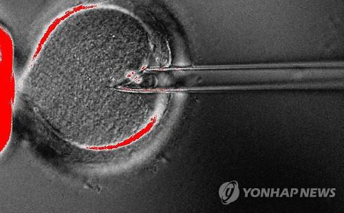 ‘세 부모 체외수정’은 미토콘드리아 DNA 결함을 가진 난자에서 핵을 추출해서 핵을 제거한 다른 정상적인 난자에 주입해 유전병의 대물림을 막는 시술이다./연합뉴스