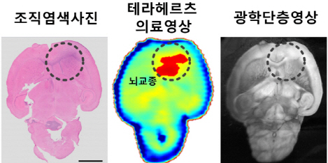 실험쥐의 뇌교종 부위를 선명하게 볼 수 있는 테라헤르츠 영상과 현재 병리검사 등에 쓰이는 뇌조직 염색 사진 및 광학단층영상. /사진제공=연세대 세브란스병원