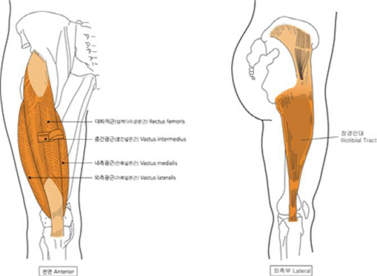 빈번히 일어나는 무릎통증 해결법