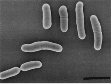 아토피성 피부염 개선 효과가 있는 김치 유산균을 전자현미경으로 찍었다. /사진제공=미래창조과학부