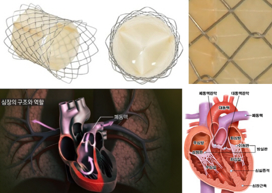 태웅메디칼의 자가확장형 폐동맥 인공심장판막과 스텐트(위), 심장의 구조(아래). /사진=서울대병원, EBS와 두산백과사전(doopedia)에서 캡처.