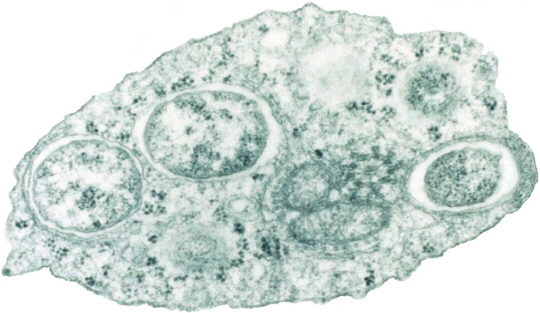 볼바키아 바이러스 전자 현미경 사진. 바키아에 감염된 수컷 모기와 감염되지 않은 암컷이 교미를 해 낳은 알은 깨어나지 못하고 죽는다.