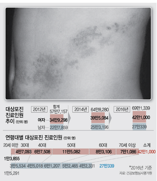 0515A24 대상포진4