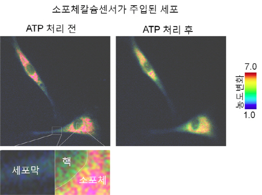 몸 속 칼슘농도 측정하는 센서 개발