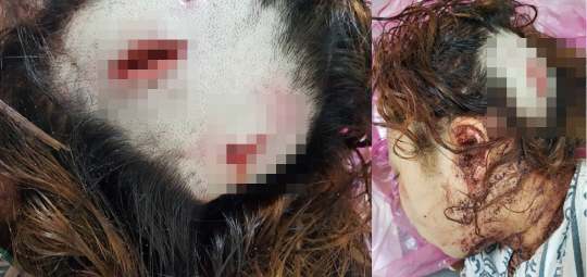 부산 여중생 폭행 사건 피해자 사진 공개...참혹한 실상, 누리꾼 ‘분개’