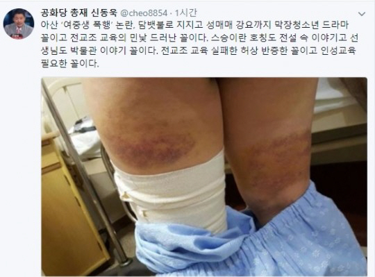 신동욱 ‘아산 폭행’ 사건 “막장 청소년 선생님도 박물관” 개처럼 굴어라 협박