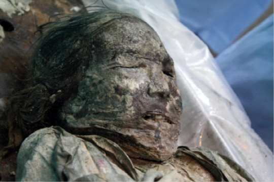 지난 2010년 경북 문경에서 미라로 발견된 400년 전 조선 여성. 죽상동맥경화증에 의한 심혈관질환으로 사망했다는 진단이 나왔다. /사진제공=플로스원