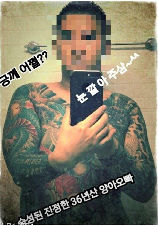 거대백악종 “턱뼈, 잇몸 제거 수술로 어금니만 남아” 온몸 문신 ‘어금니 아빠’