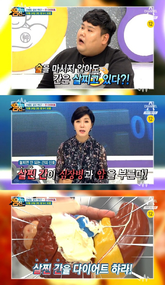‘나는 몸신이다’ 김수영, 지방간 검진 결과 ‘충격’…“위급한 상태”