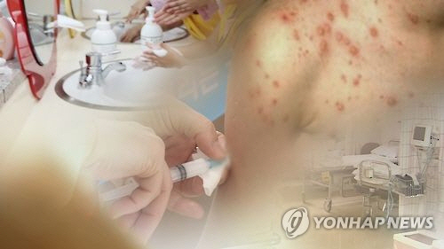 올해 수두 환자가 지난해보다 40% 이상 급증한 것으로 나타났다./연합뉴스
