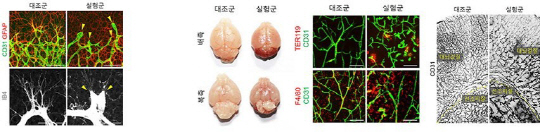 YAP/TAZ 전사인자의 발현이 억제될 경우, 혈관신생에는 이상현상이 발생한다. (맨 왼쪽) 끝세포가 꽈리모양으로 변하면서 사족형성이 더뎌진다. 2번째 사진은 전사인자를 억제한 실험군에서 산발적인 뇌출혈과 뇌의 이상혈관이 관찰된 것을 보여준다.