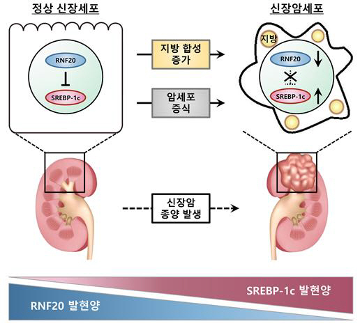 지방 합성에 따른 신장암 종양 발생 메커니즘. /서울대 제공