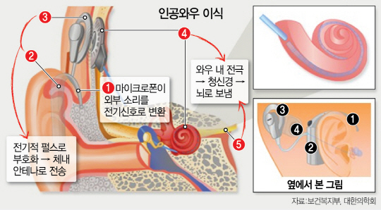 2315A32 인공_c