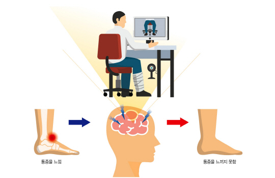 통증완화 개념.