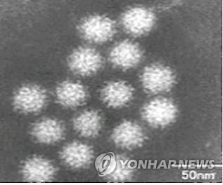 부천 고등학교서 53명 집단 구토·설사…노로바이러스 검출