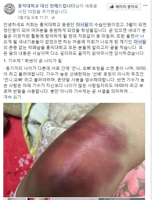 한 대학생이 동아리 선배들로부터 구타당했다며 페이스북 페이지 ‘홍익대학교 대신 전해드립니다’에 올라온 글과 사진 / 페이스북 페이지 캡쳐