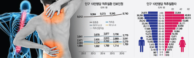 연간 800만명 괴롭히는 척추질환, 연령마다 단골 부위 따로 있다는데...