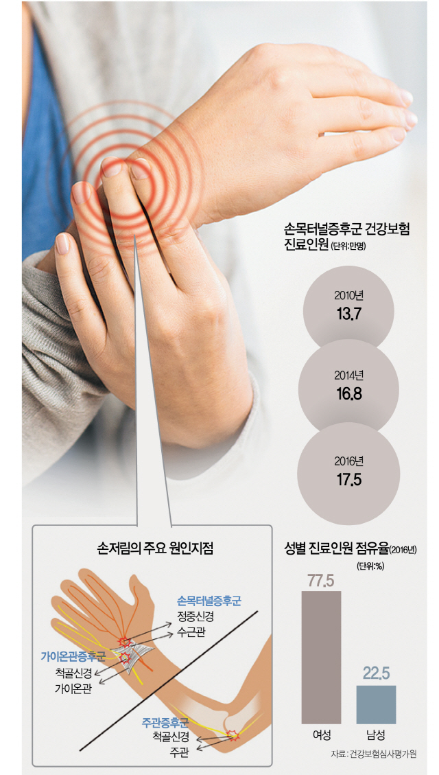 손목터널증후군, 파스로 버티다간 통증만 키워요 : 서울경제
