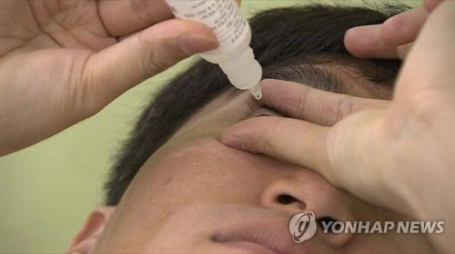 무좀약이나 순간접착제 등을 안약으로 착각해 눈에 넣는 사고가 많이 발생하고 있는 것으로 나타났다./연합뉴스