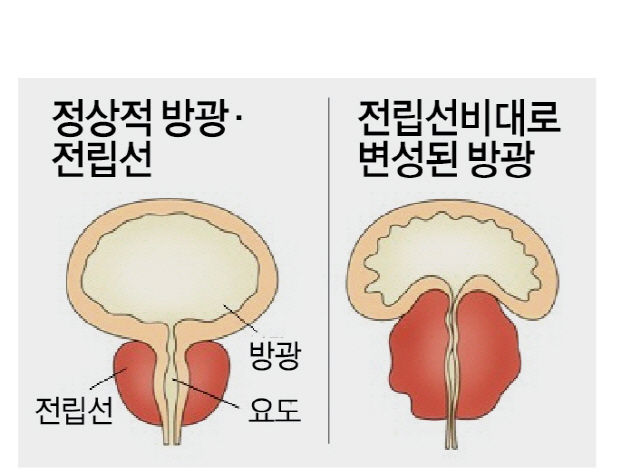 0915A24 정상적