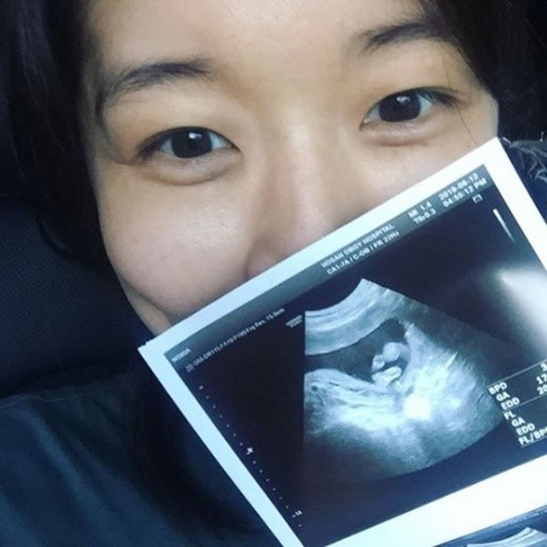 김빈우, 둘째 임신 깜짝 발표 “17주 차…감사합니다”