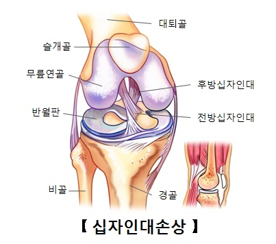 [건강하게 월드컵 즐기기] 휴식 없는 축구…'부상태클' 걸려요