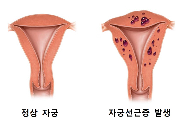 *출처: 미국 메이요클리닉(mayoclinic) 홈페이지