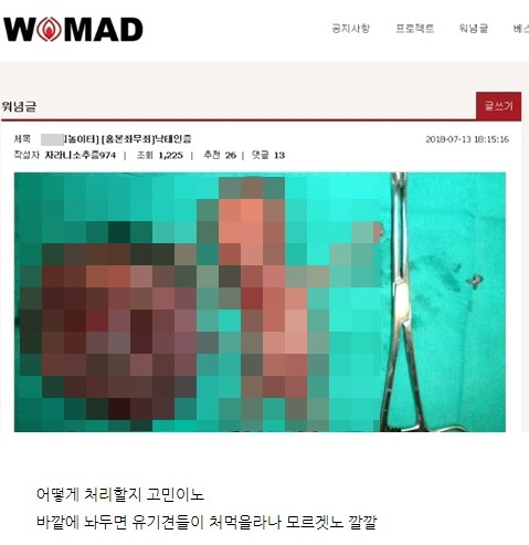 워마드, 이번에는 태아 난도질 사진…'유충낙태는 에티켓' '군침돈다' 도 넘은 댓글